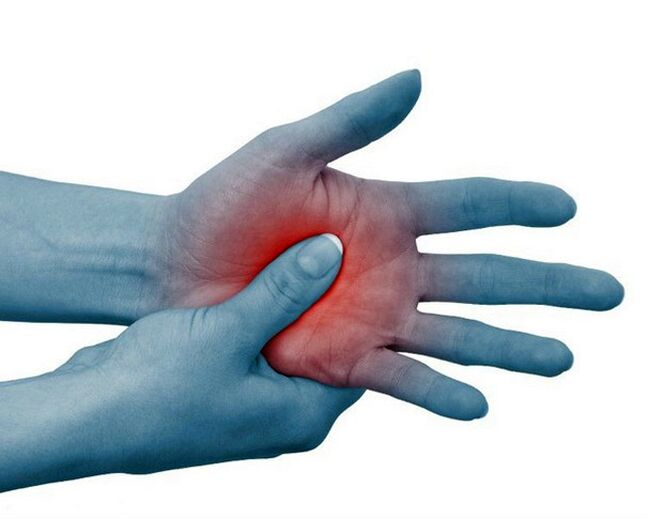 Severe pain in the joints of the fingers, which decreases with exercise, is a typical sign of rheumatoid arthritis.