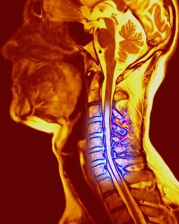 Cervical cartilage